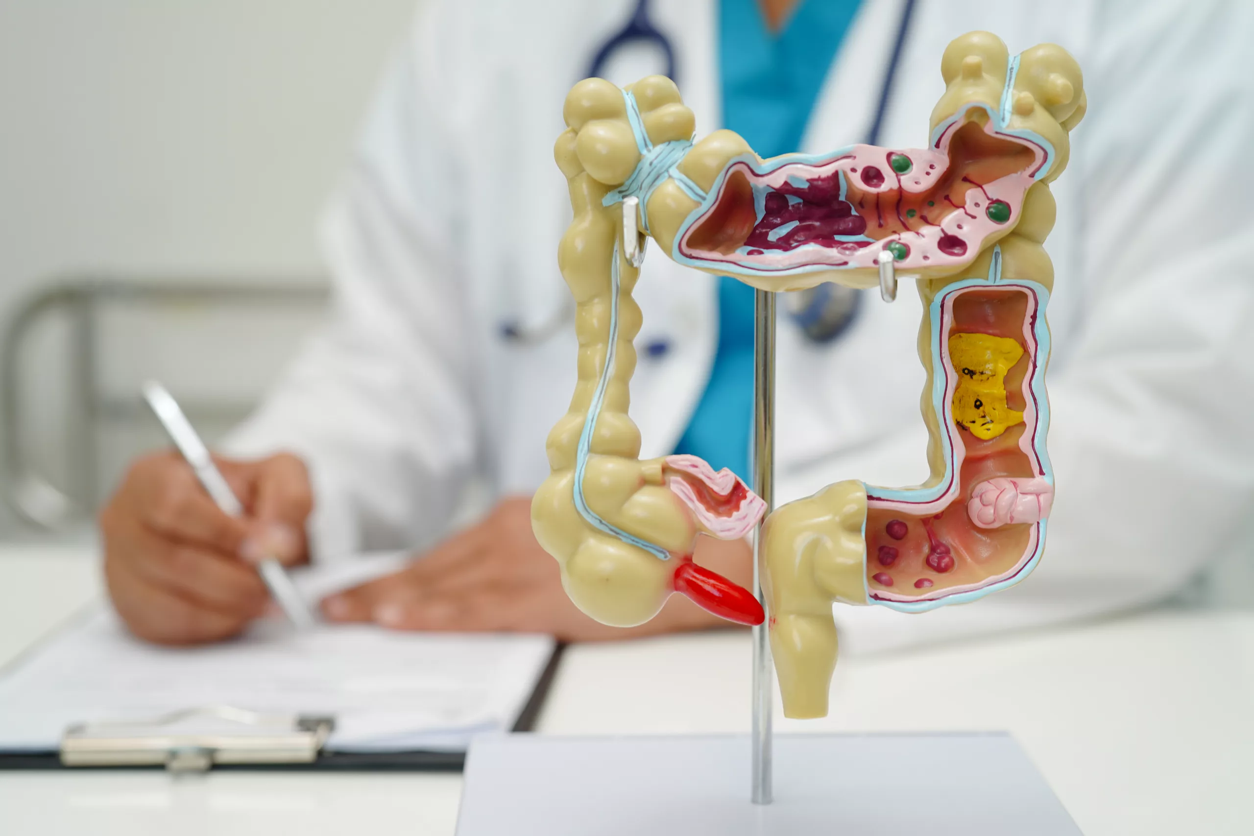 Мультидисциплинарное лечение распространённого колоректального рака в клиниках Германии